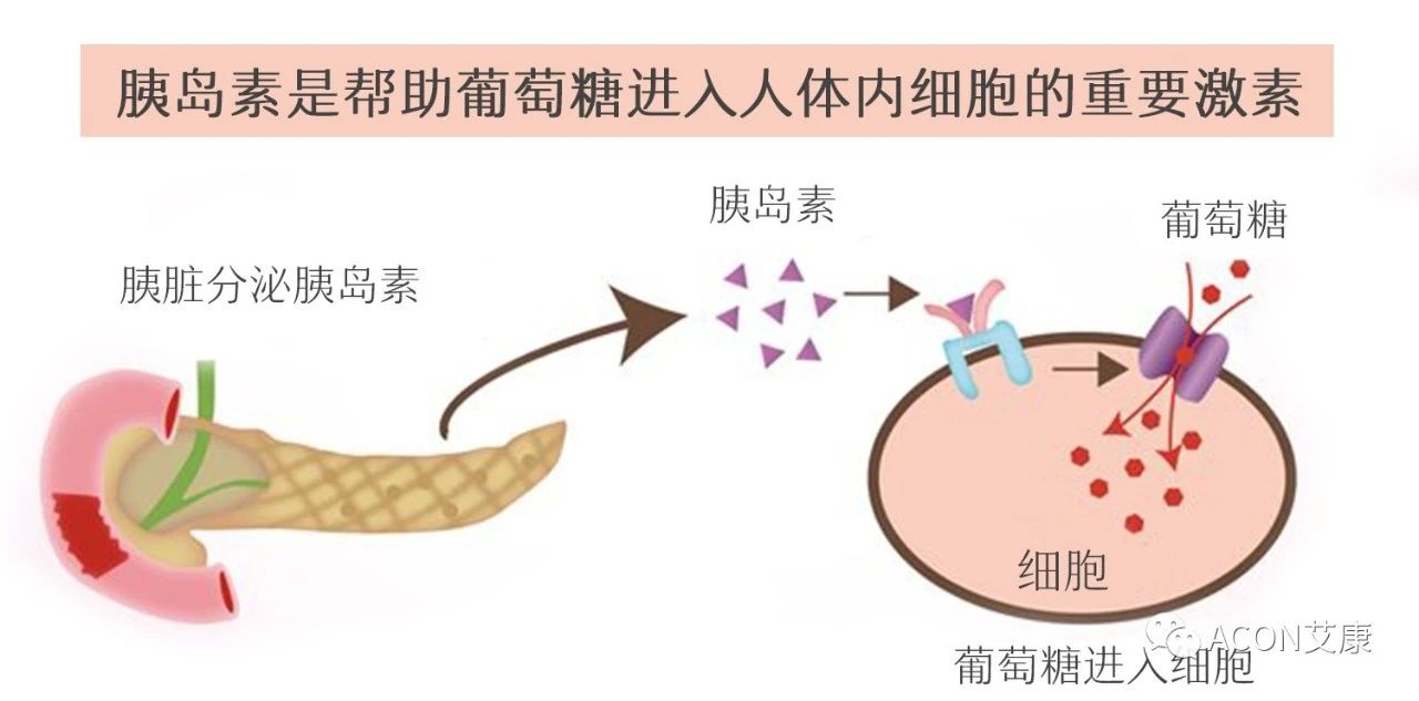 爆上熱搜，因爆發(fā)型糖尿病進入ICU，有哪些教訓值得我們汲取